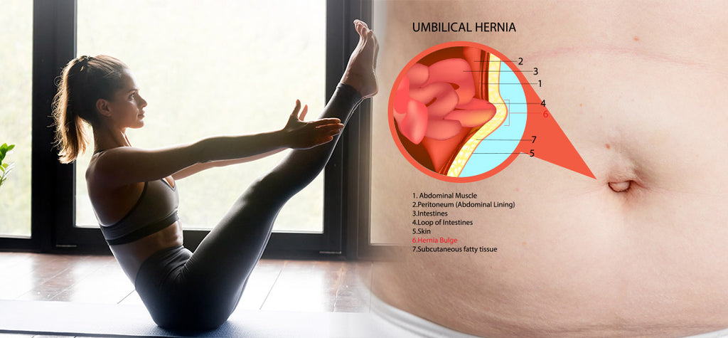 Umbilical Hernia Pain Relieving Exercise: Know the Steps