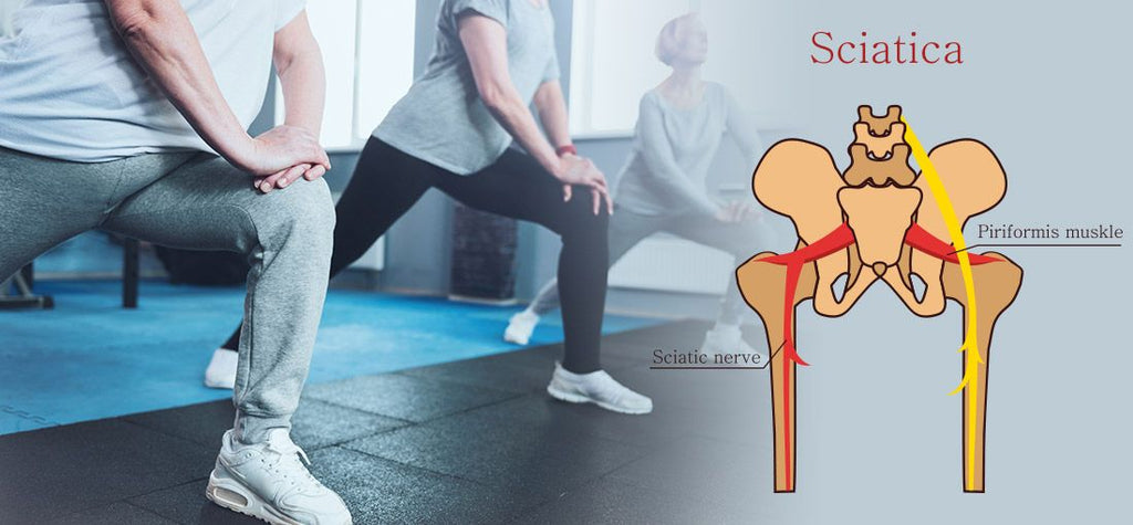 Causes, Symptoms, & Prevention for Sciatica Pain