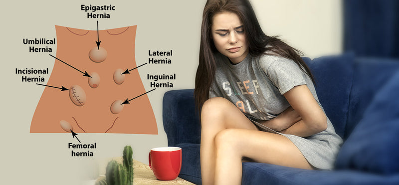 hernia treatment