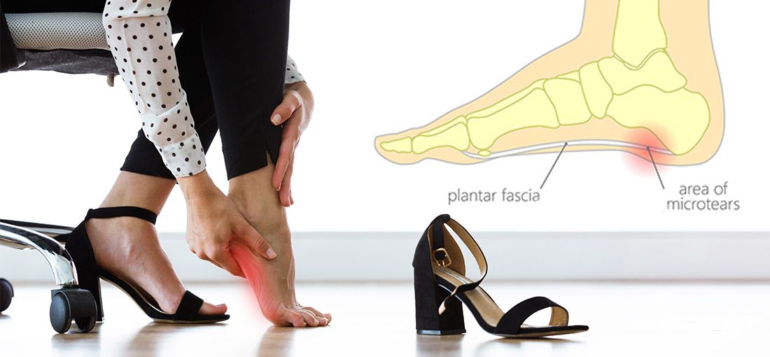plantar fasciitis treatment