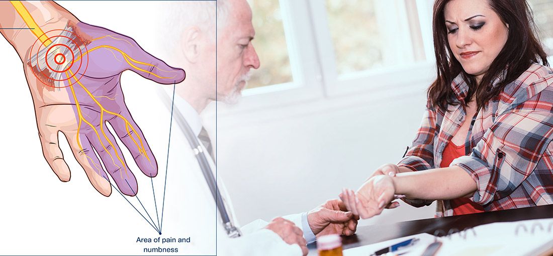 Carpal Tunnel Syndrome
