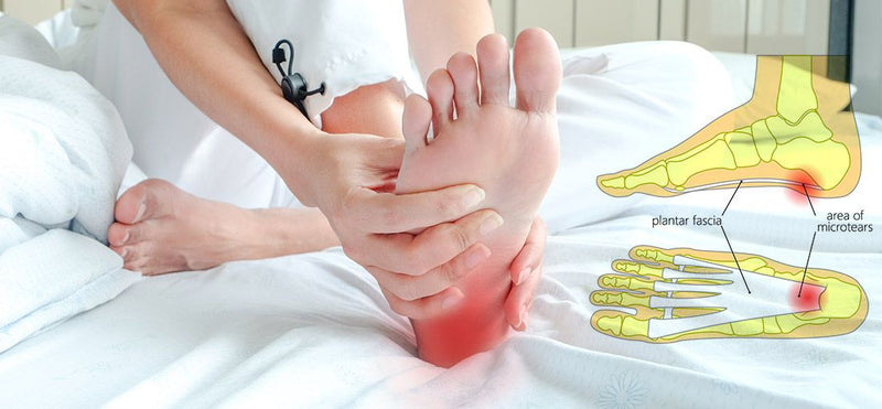 Foot Pain from Plantar Fasciitis