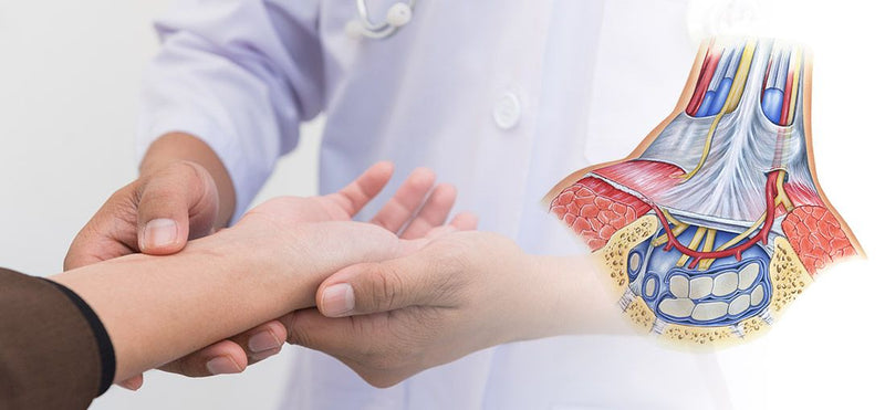Carpal Tunnel Syndrome