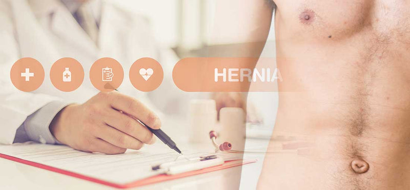 Abdominal Hernia
