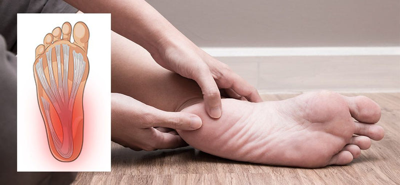 Plantar Fasciitis