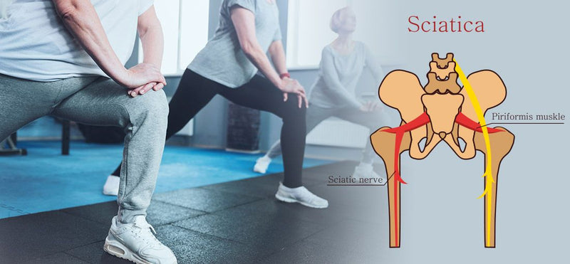 Sciatica Pain