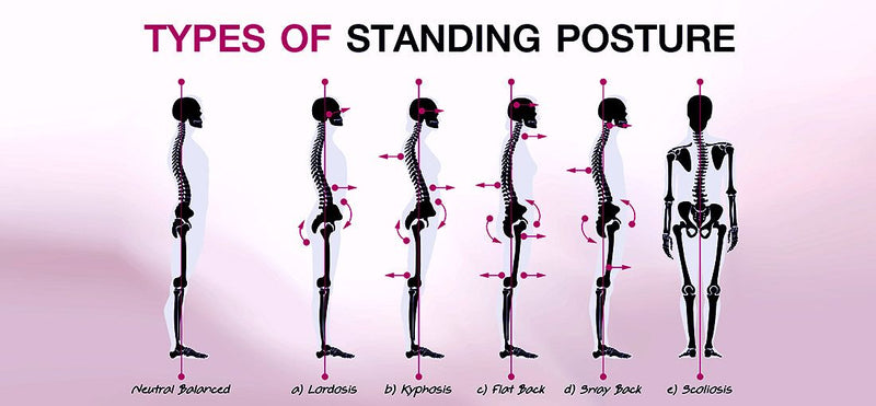 Posture Correction Support: Do You Know Your Posture Type? – Everyday  Medical