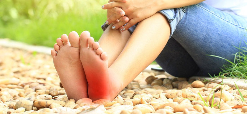 Plantar Fasciitis