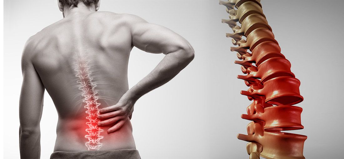 Lower Back Pain