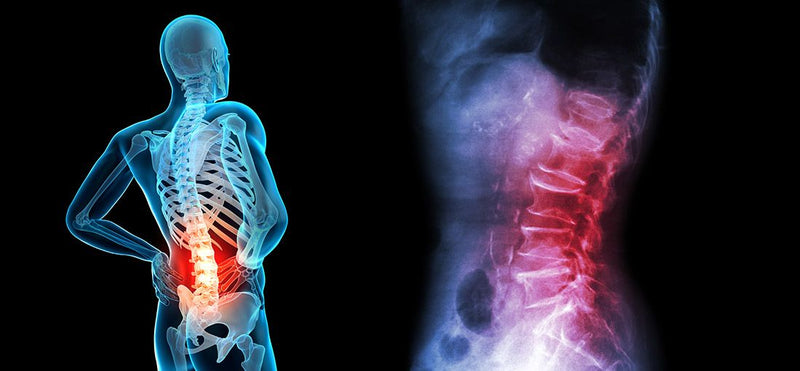 Lumbar Pain