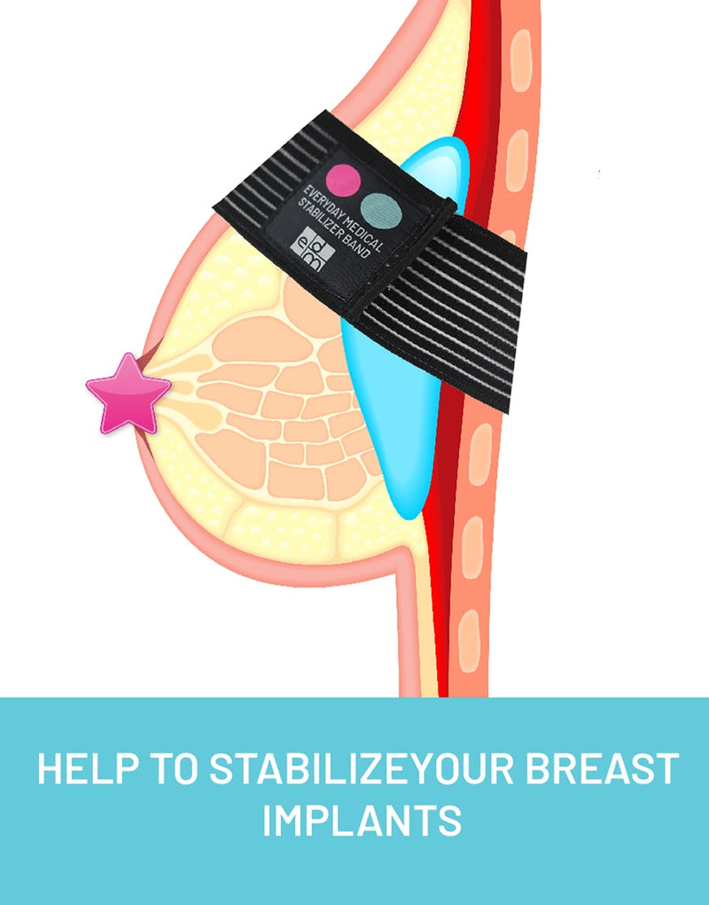Medical Breast Band - Implant Stabilizer Band Bundle