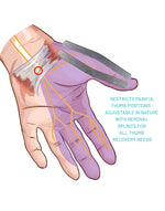 CMC Thumb Splint-Everyday Medical